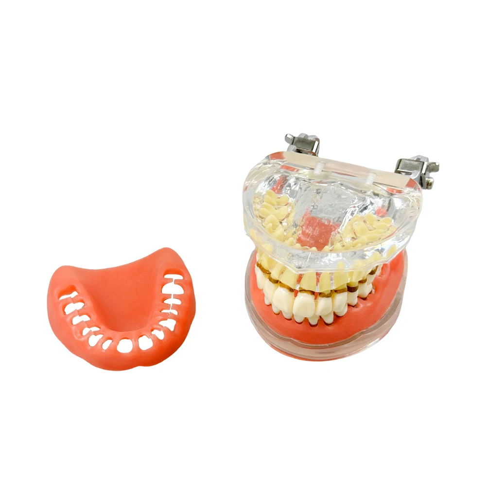 Periodontal Disease Model Dental Teeth Model Dentist Student Model Soft Gums Removable Tooth Typodont For Patient Education Demo