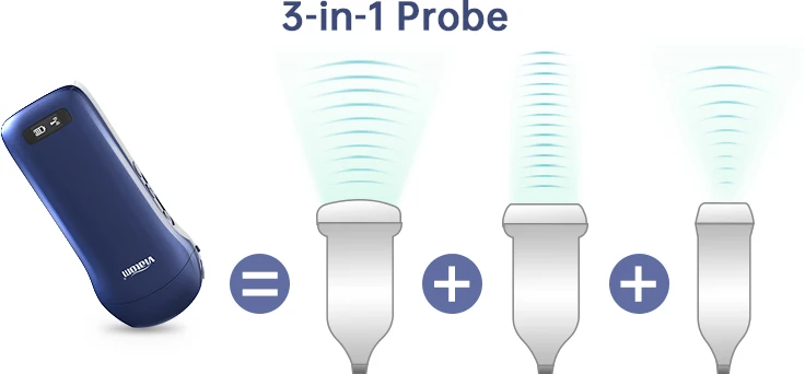 Viatom 128 要素ワイヤレスポータブル超音波スキャナーワンプローブ多目的ハンドヘルド超音波プローブ