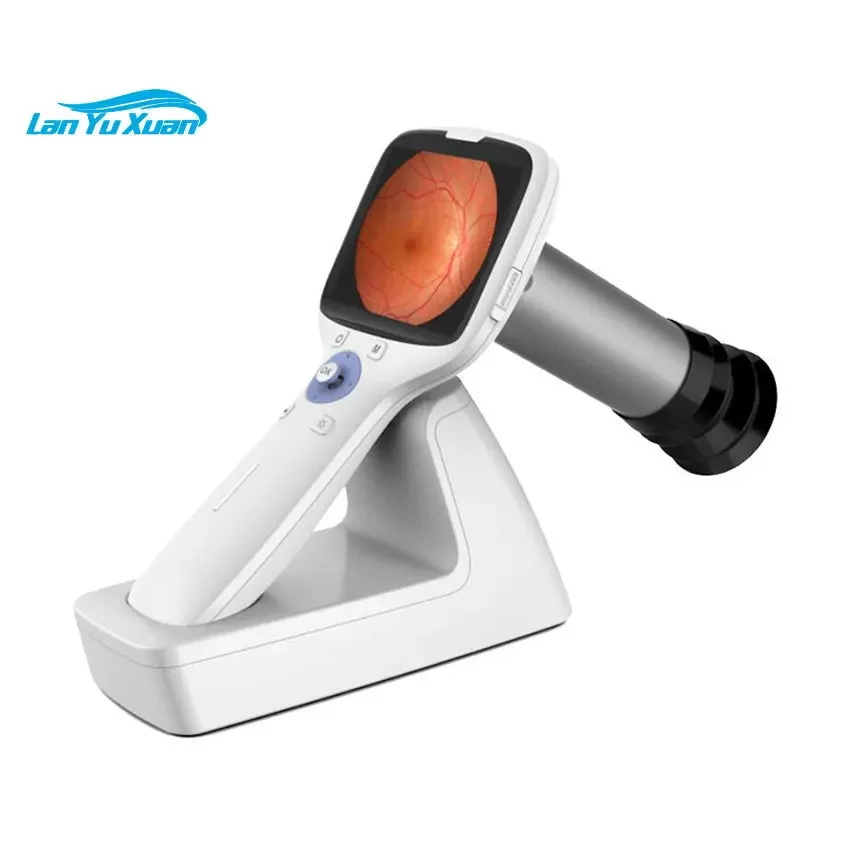 MY-V038 plus ophthalmology equipment portable eye fundus camera handheld