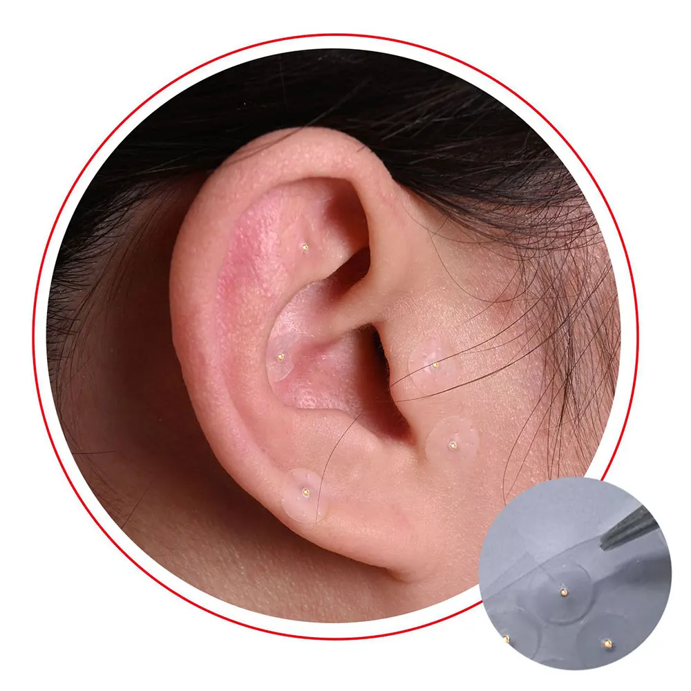 100Pcs Cowherb Seed Ear Stickers Auriculotherapy Acupuncture Massage Therapy Dredge Body Meridians Improve Vision Treat Insomnia