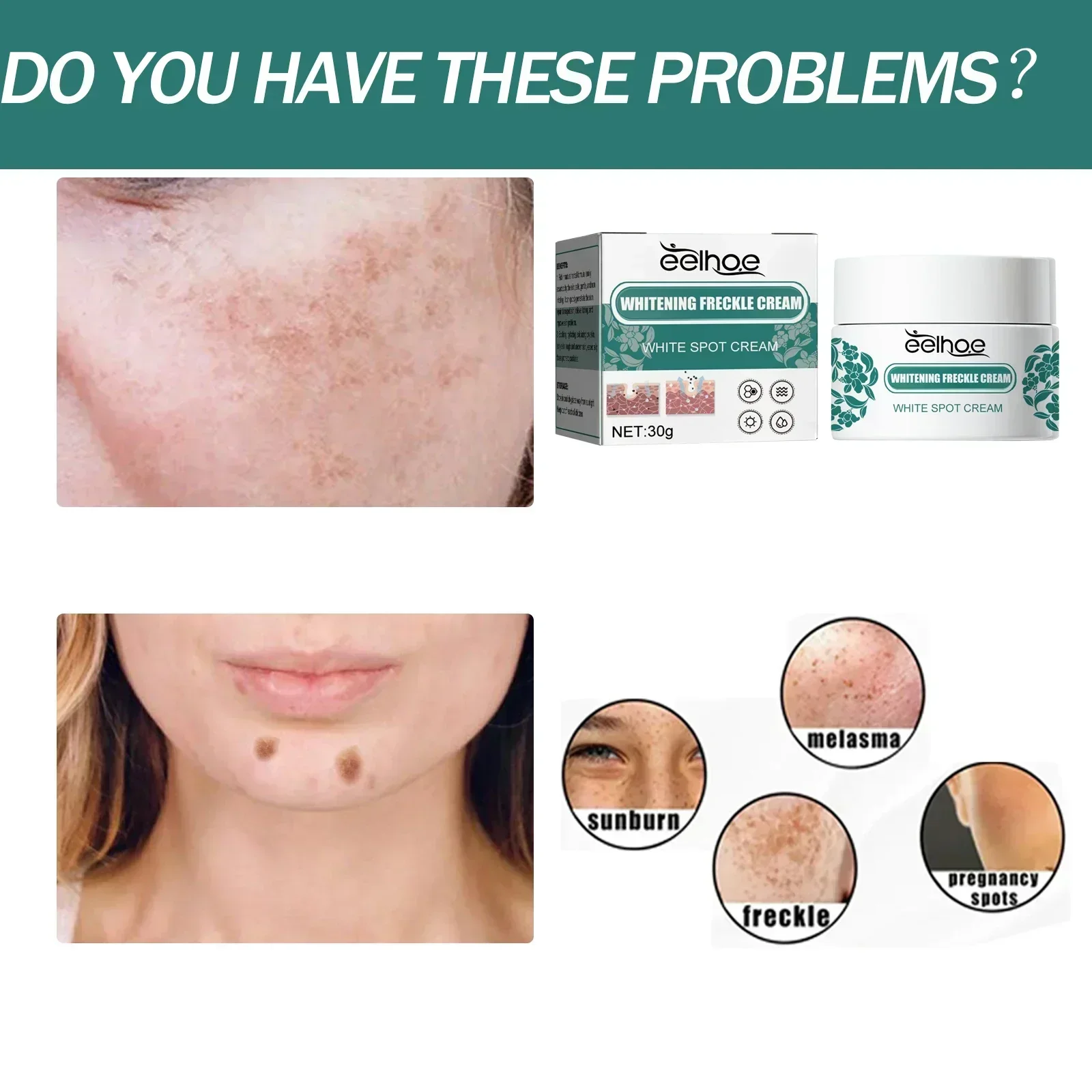 Removal Dark Spots Freckles Brighten Facial Skin Firming Whitening Frckle Cream Products Reduce Melanin Lighten Dark Skin