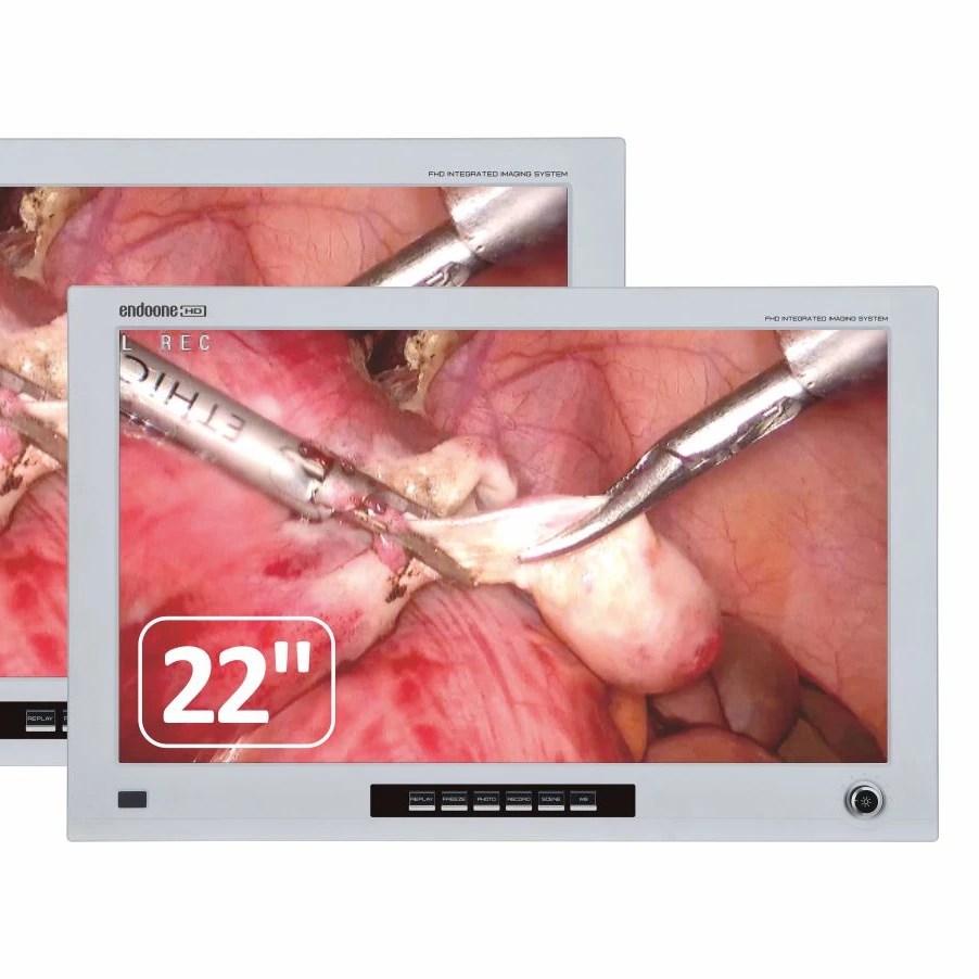 4-in-1 FHD Image Quality All-in-One Hospital Surgical Medical 22/26 Inch Endoscope Endoscope Camera System