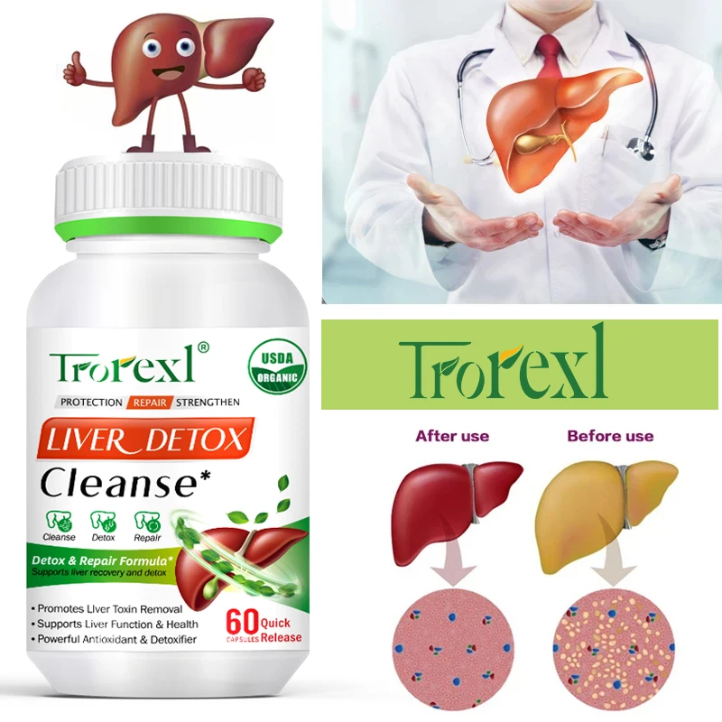 Liver Detox Cleanse Capsule Herbal Formula Pueraria Lobata Liver Protecting Capsules, Fatty Liver Repair Formula, Lipid Lowering