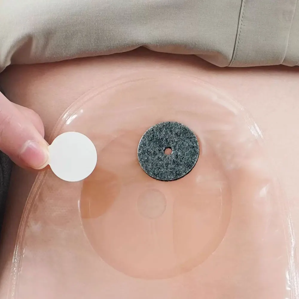 10Pcs Ostomy Bag Disposable Activated Carbon Filter Stoma Care Odor Bag Filter Sticker Ostomy Bag Stoma Protective Cover