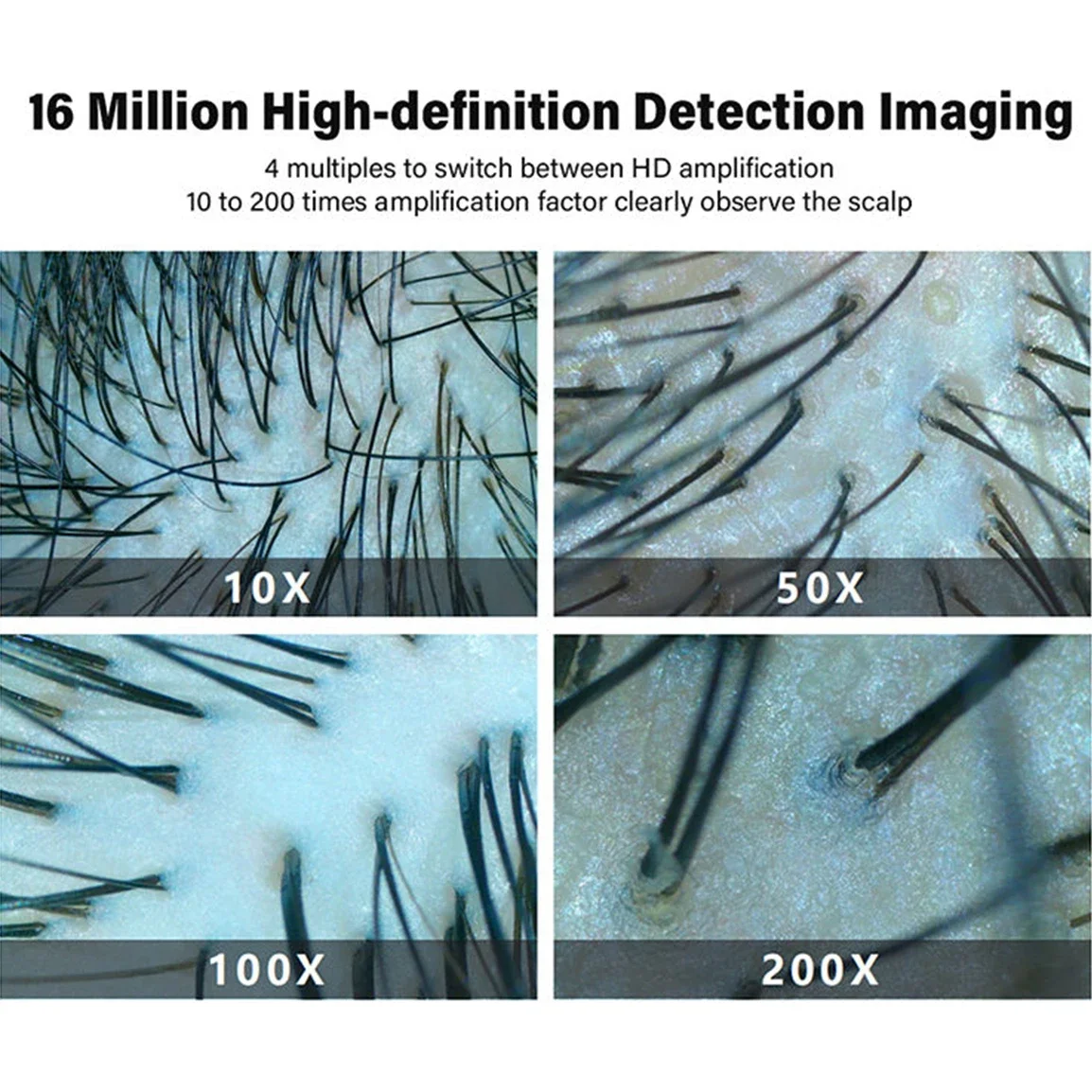 

3D Scalp And Skin Analysis Camera 400X Light Ai Android Portable Hair-Scalp-Analyzer-Machine