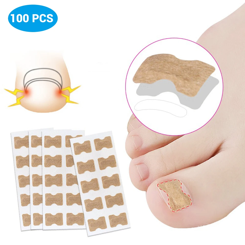100Pcs Adhesive Ingrown Toenail Correction Stickers Elastic Nonwoven Flexible Ingrown Toenail Patches Breathable