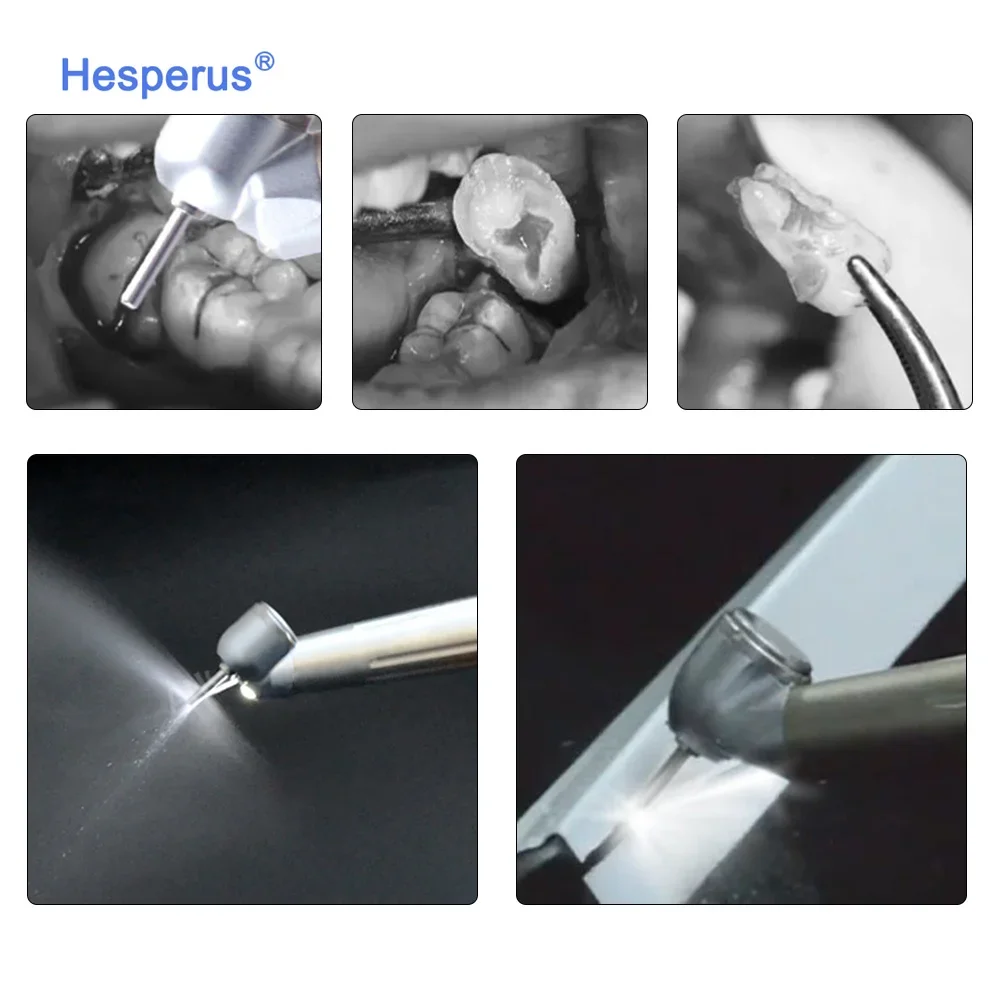 Dent al 45 Degree Standard Push Button High Speed Surgical Handpiece Single Way Spray For Block Tooth/wisdom