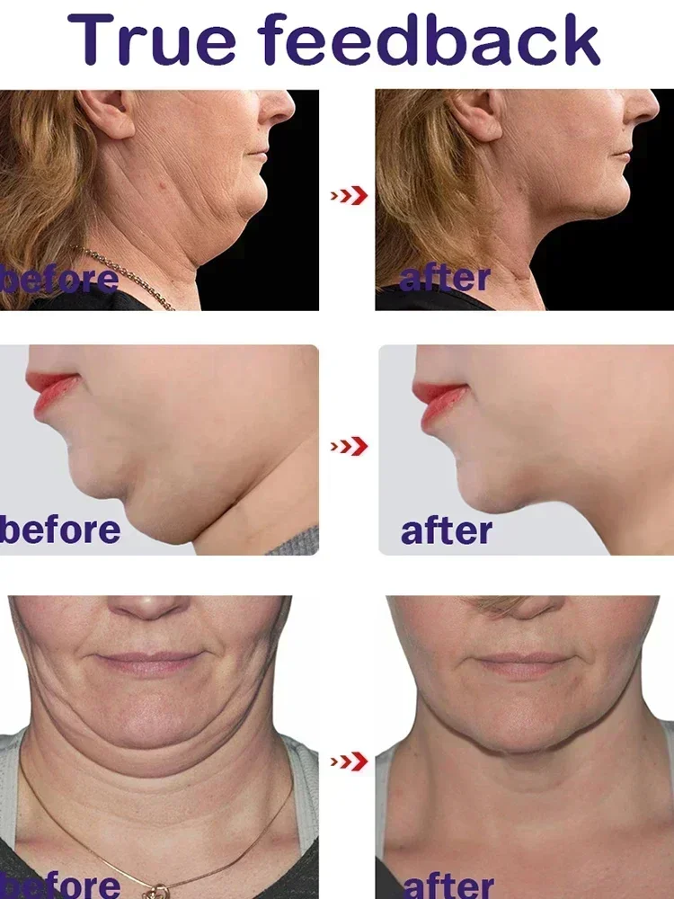 Slimming Face Cream V-Shape Double Chin Fat