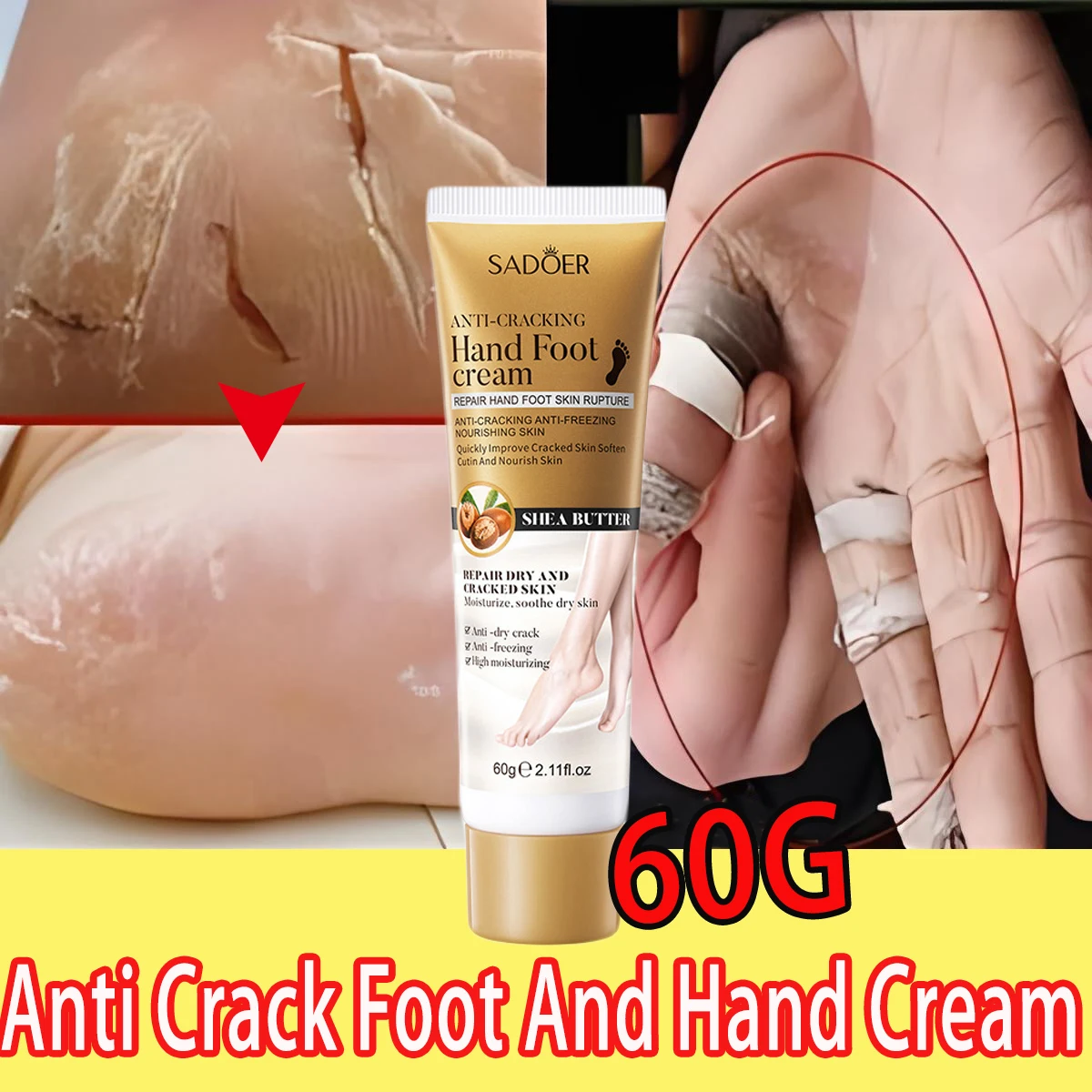 Herbal Anti Crack Foot Cream Heel Cracking Repair Products Exfoliation Dead Skin Removal Softening Moisturize Whiten Skin Care