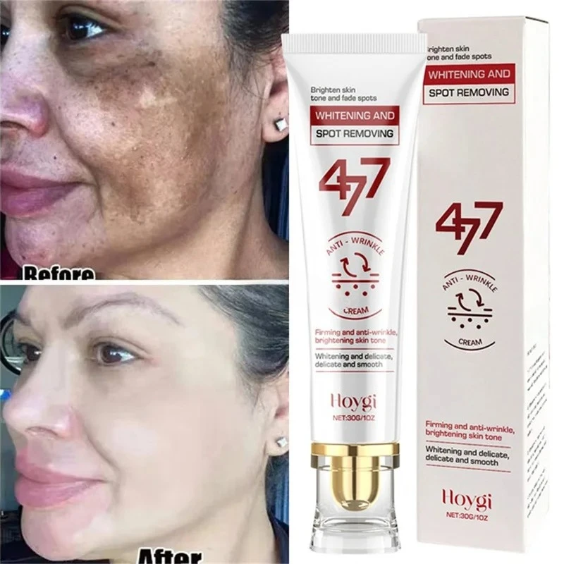 Powerful Spot-Removing Whiten Cream Brighten Skin Fast Eliminates Melanin Pigmentation Melasma Dark Spots Korean Face Skin Care