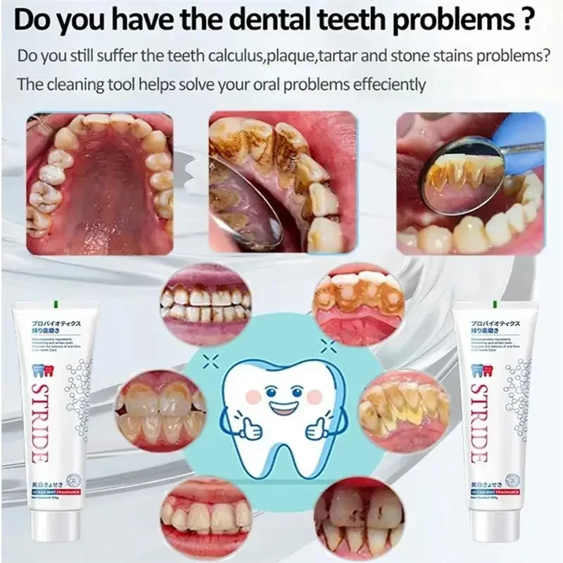 Removedor de cálculo Dental, pasta de dientes para prevenir la Periodontitis, eliminación del mal aliento, cuidado de limpieza de dientes amarillos