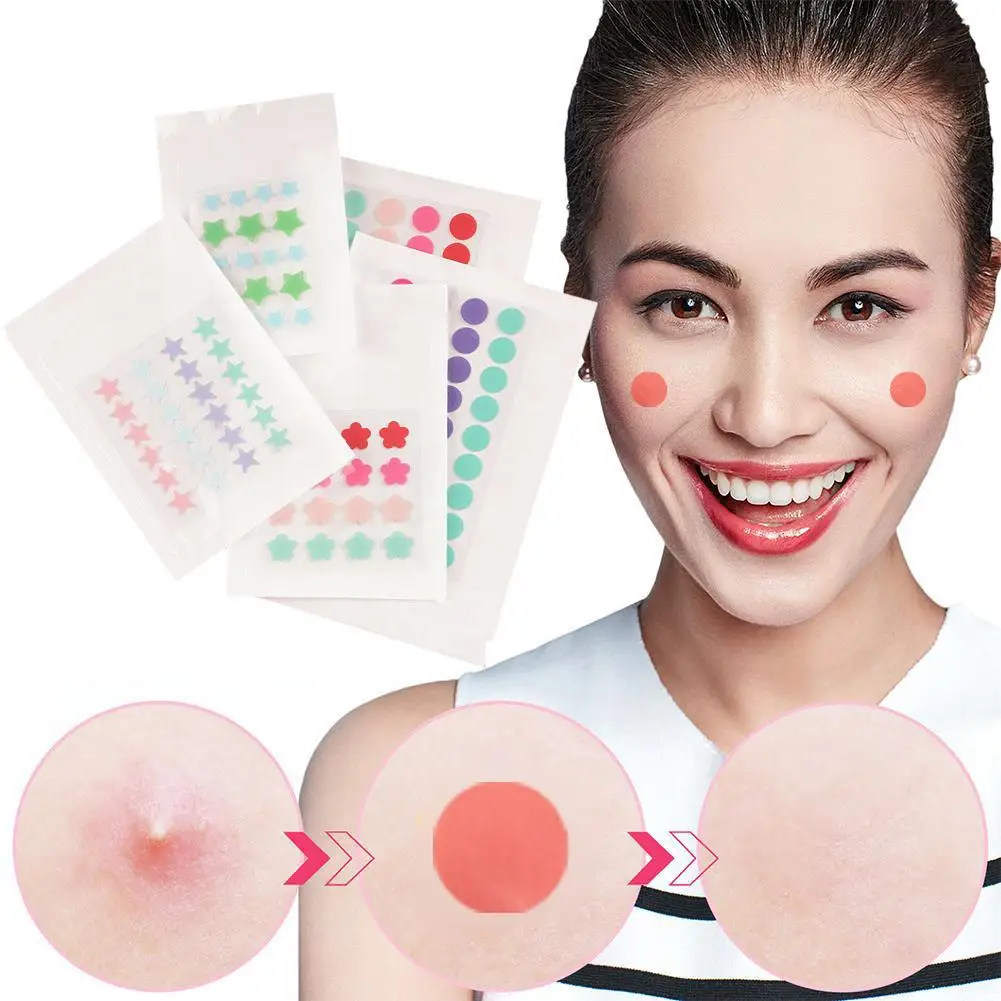 Waterdichte Acne Puistje Behandeling Stickers Spot Verwijdering Mee-Eter Zorg Concealer Schrik Gezicht Sproet S Y6s8