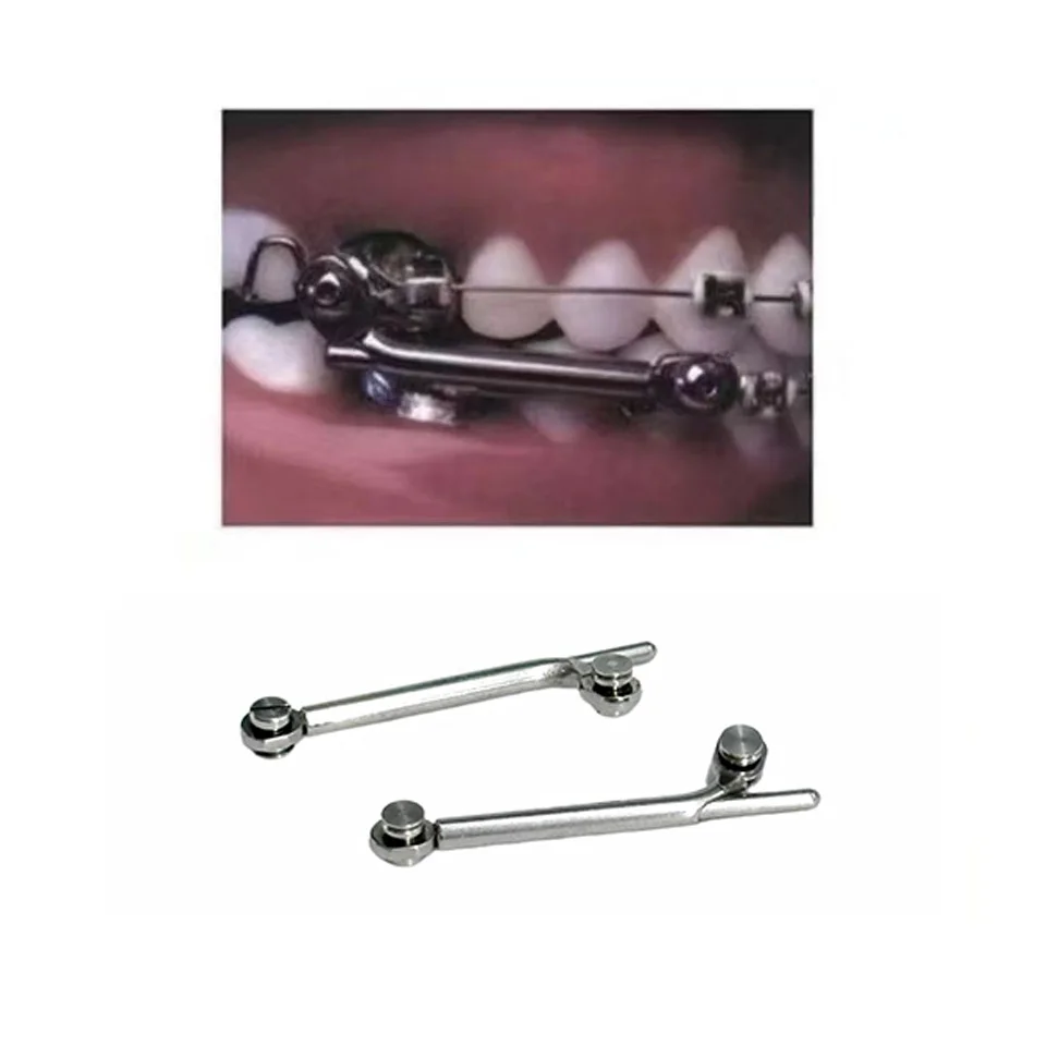 Fixed Functional Herbast Appliances Orthodontic Tool for Class II Mandibular Retrognathia Correction Professional Dental Lab