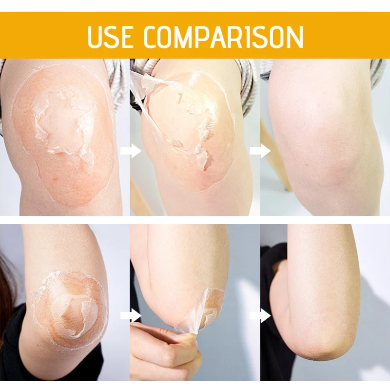 100g Vitamin C Nourishing Peeling Lotion Improve Pigmentation Fingers Knees Uniform Skin Tone Moisturizing Smooth Skin Care