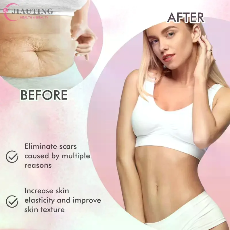 OceAura Nourishing Body Oil Fade Scars Stretch Marks Fine Lines Repair Moisturize Soften Smooth Body Skin