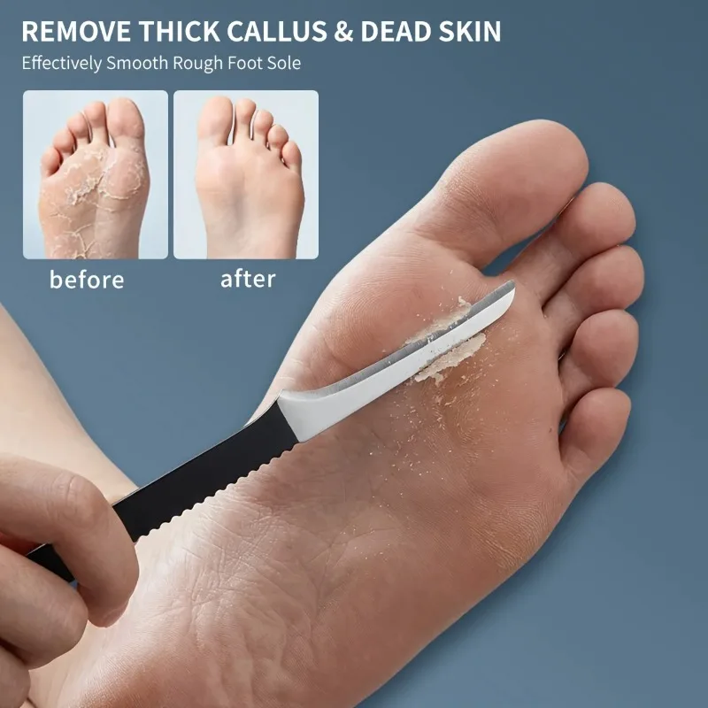 5PCS Pedicure Knife Tool Set Professional Stainless Steel Foot Dead Skin Remover Callus Scraper Foot Care Kit Ideal Gift for Men