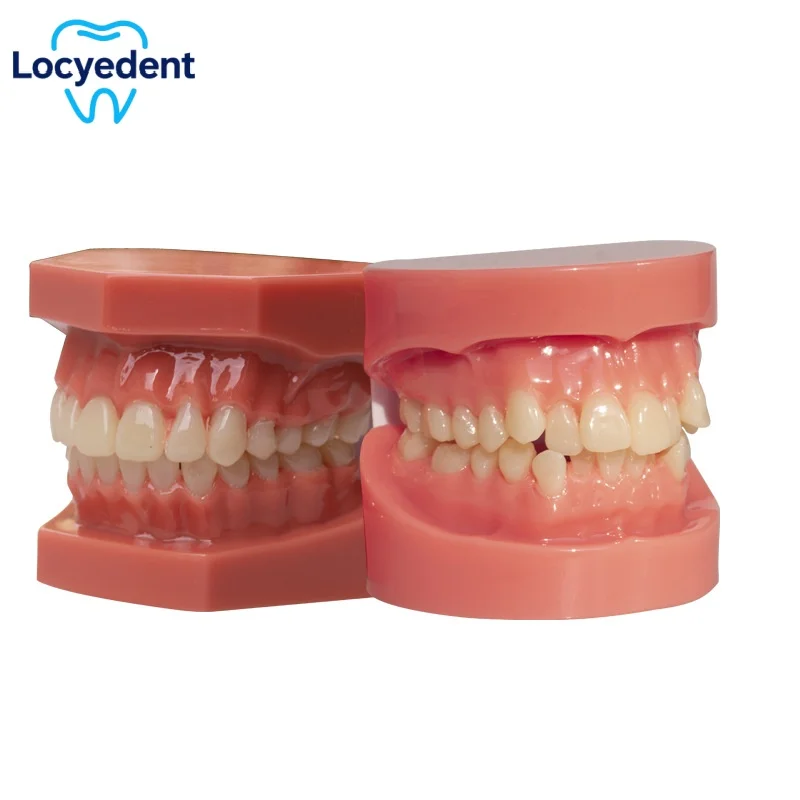 

Dental Teeth Model Teaching Study Demonstration Model Standard Adult Typodont Jaw Model For Practice Training Dentistry Products