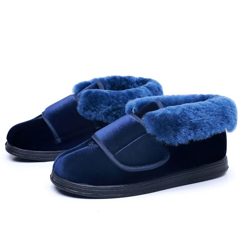 

Новые расширяющиеся регулируемые теплые хлопковые туфли с вырезом из натуральных волос, модные опухшие беременные женщины, водители, диабет, толстая нога