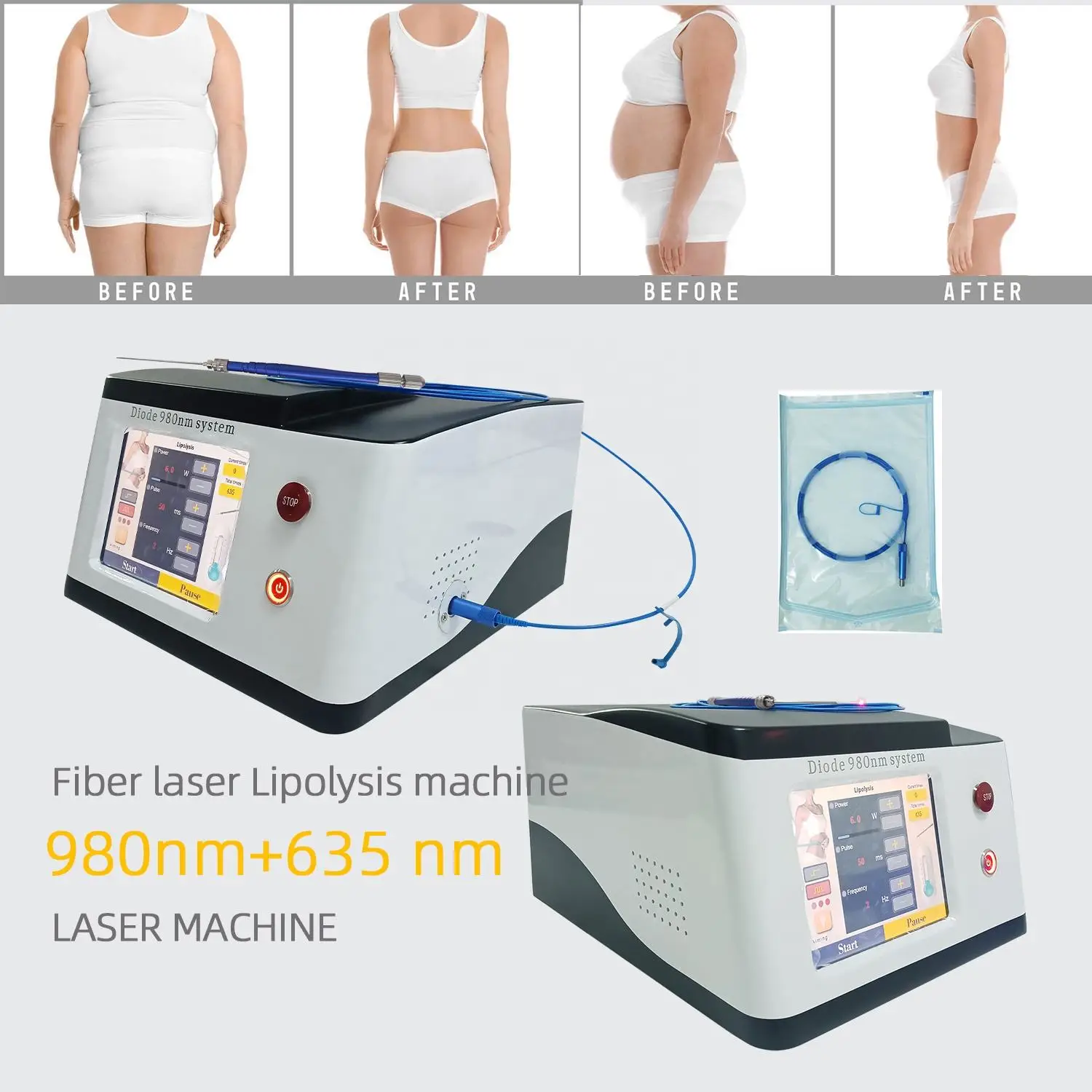 

Portable Diode Laser 980nm 1470nm +635nm with Cooling Feature Eliminates Red Blood Streaks Relieves Acne Dissolves Fat on Skin