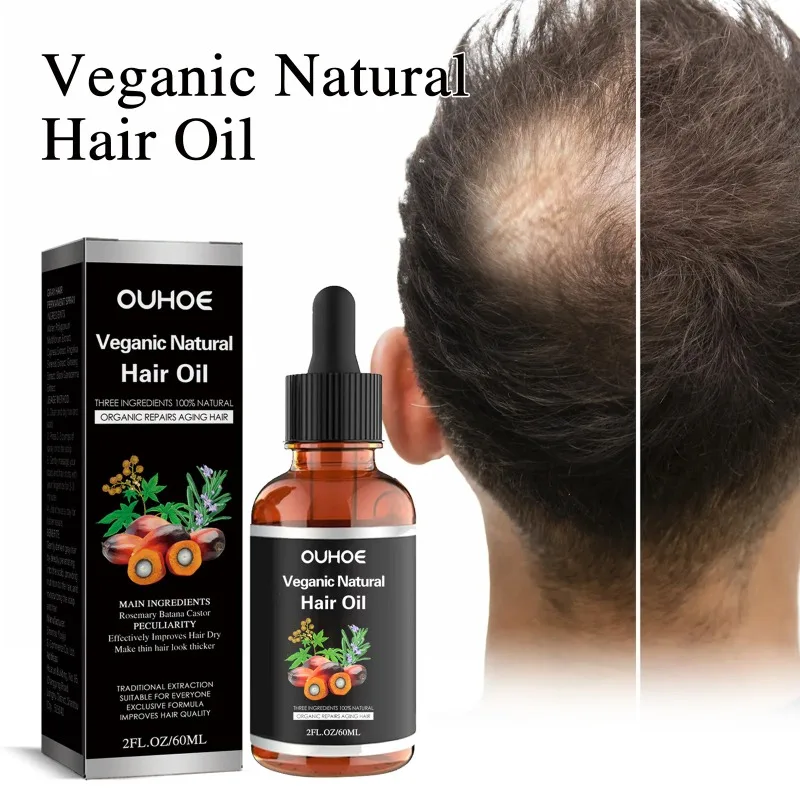 Óleo De Crescimento Do Cabelo Natural, Reparação Da Calvície, diluindo Tratamento Do Couro Cabeludo, Pós-parto Hereditário, Seborréico Anti Hair Loss Serum, Veganic