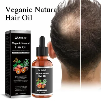 Óleo De Crescimento Do Cabelo Natural, Reparação Da Calvície, diluindo Tratamento Do Couro Cabeludo, Pós-parto Hereditário, Seborréico Anti Hair Loss Serum, Veganic