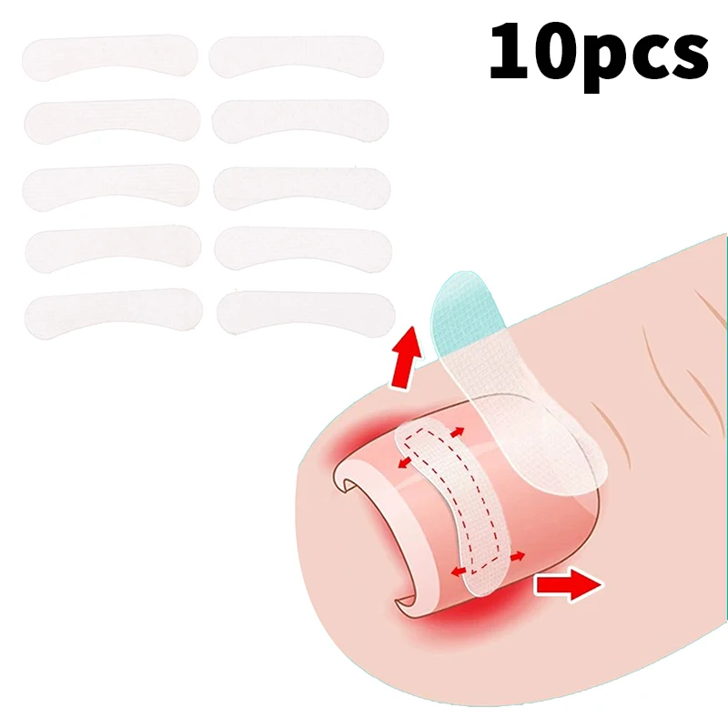 10Pcs Toe Nail Treatment Elastic Patch Sticker Pedicure Tool Ingrown Toenail Correction Tool Straightening Clip Brace Ingrown