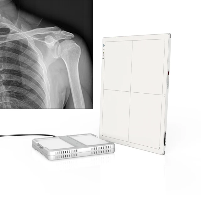 17*17 Inch Iray DR Wireless Flat Panel Detector Medical X Ray Equipment Wireless Digital X-ray Flat Panel Detector