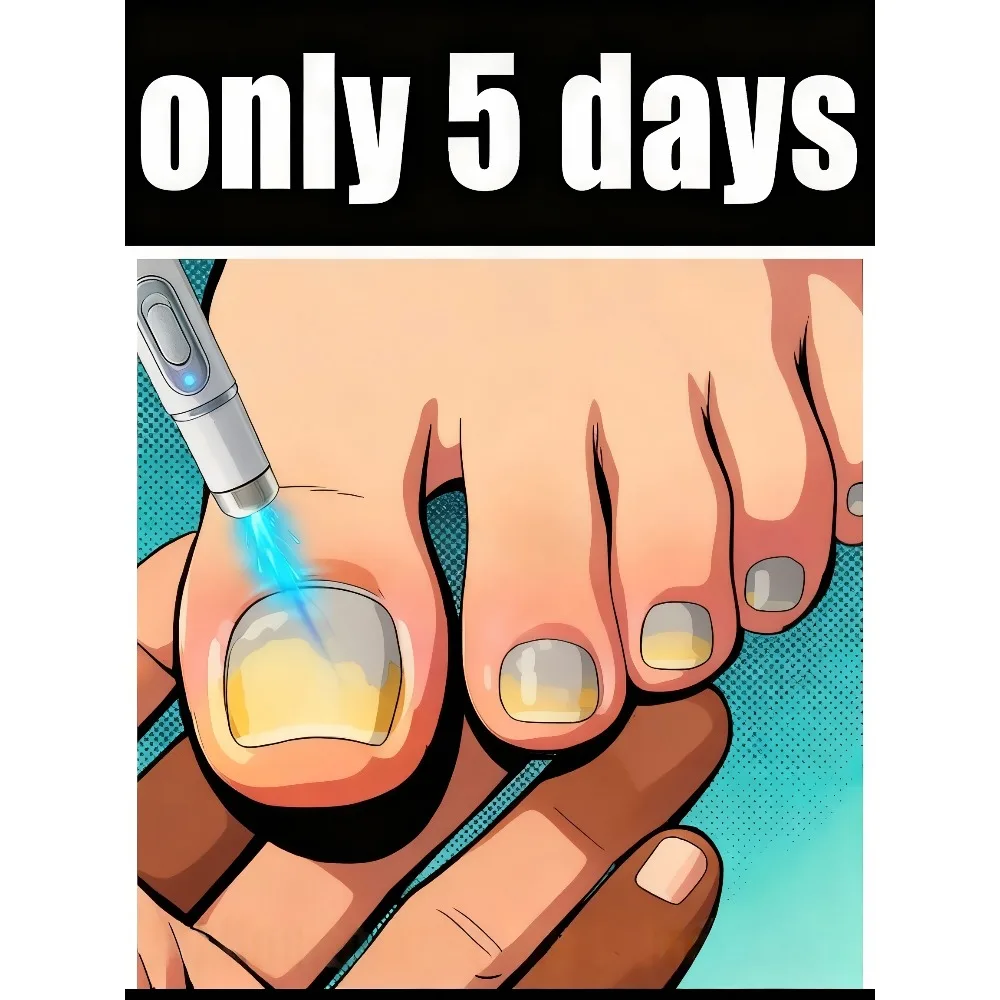 

Laser pen blue light pen maintain a healthy body