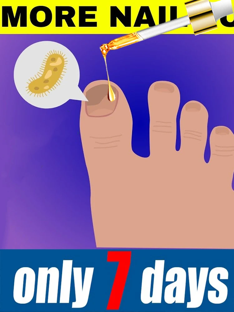 

Изменяет жизнь и помогает вам сказать прощание. Лазерная ручка для ногтей цвета шампань.