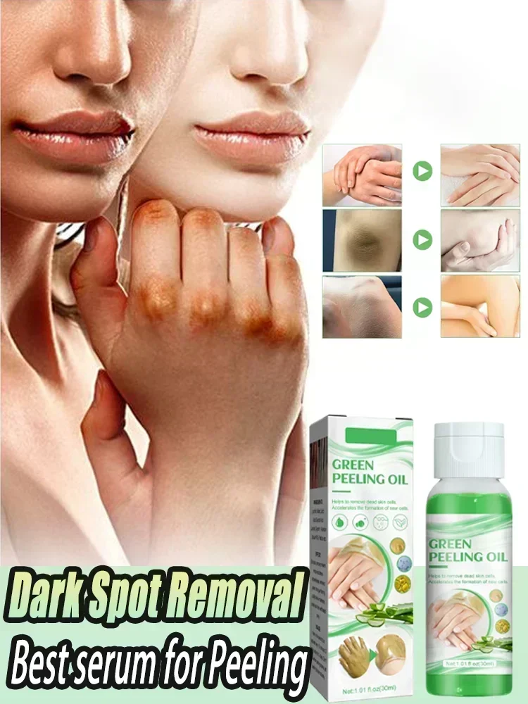 Olio esfoliante verde Olio peeling per il corpo Idratante Sbiancamento per il corpo Rimuovi la melanina Migliora lo sbiancamento opaco Schiarente Cura della pelle