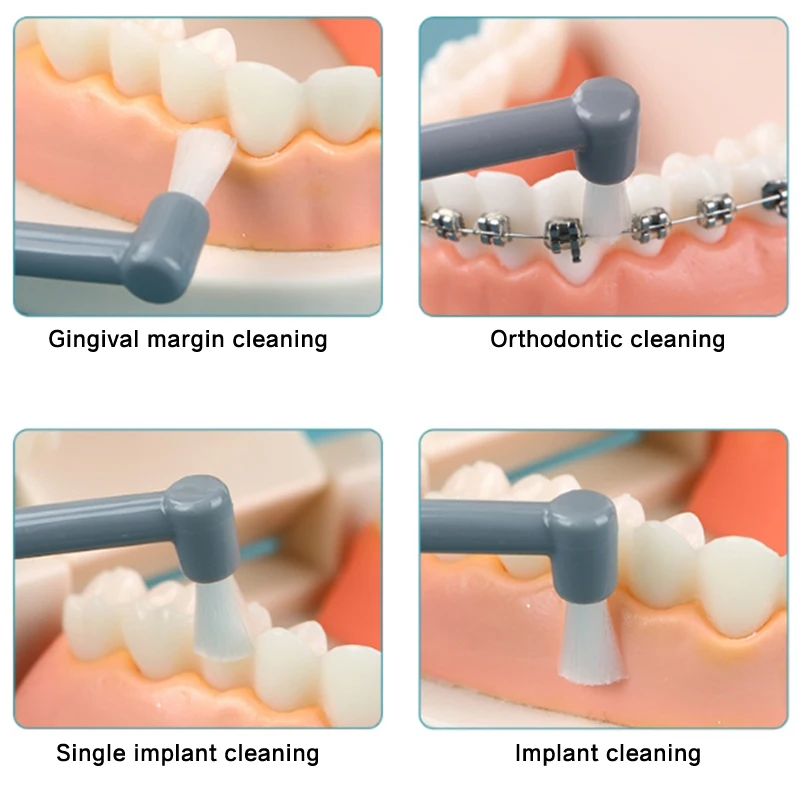 1 Stuks Cluster Kleine Platte Kop Tandenborstel Enkele Bundel Orthodontische Borstel Interdentale Borstel Interdentale Borstel Mondverzorging Tool