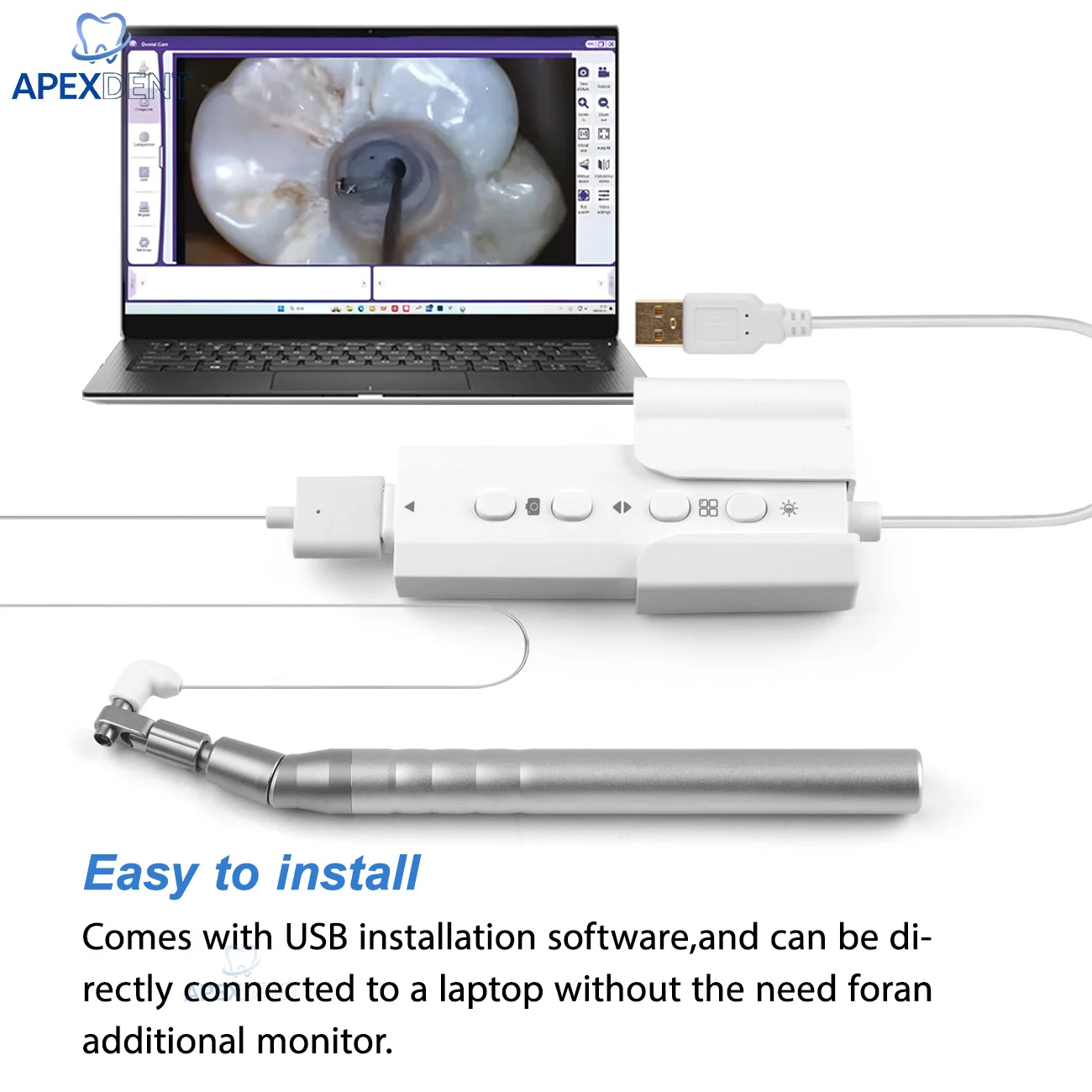 Two Types Dental Root Canal Visualization Mini Micro Intra-oral Camera HD LED Oral Scanner Micro Sensor Dentistry Lab Equipment