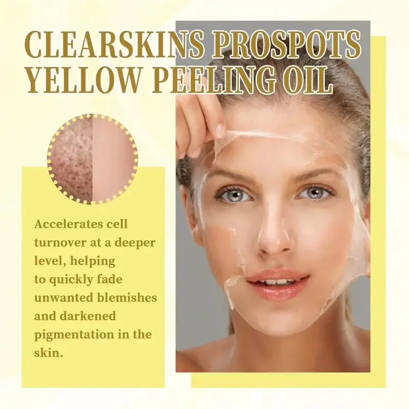 Yellow Peeling Oil Bleaching Dark Skin Spots Remove Dead Skin Lighten Melanin Exfoliating Whitening Moisturize Face Skin Care