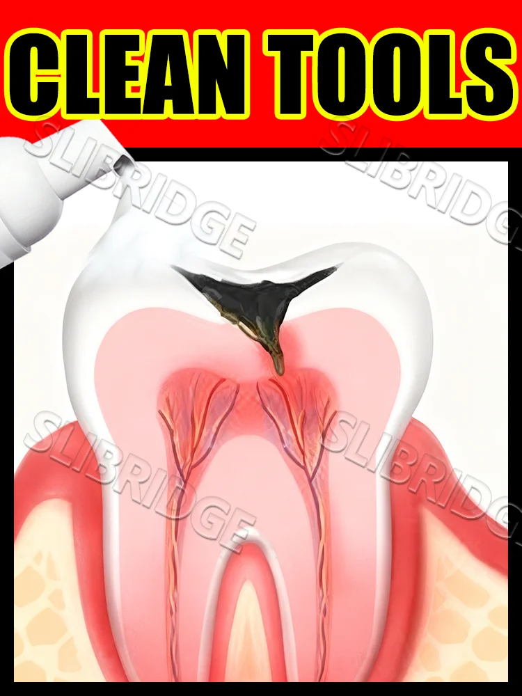 

Intraoral Mousse clean tools,One sip of foam,a heart of protection,Free shipping