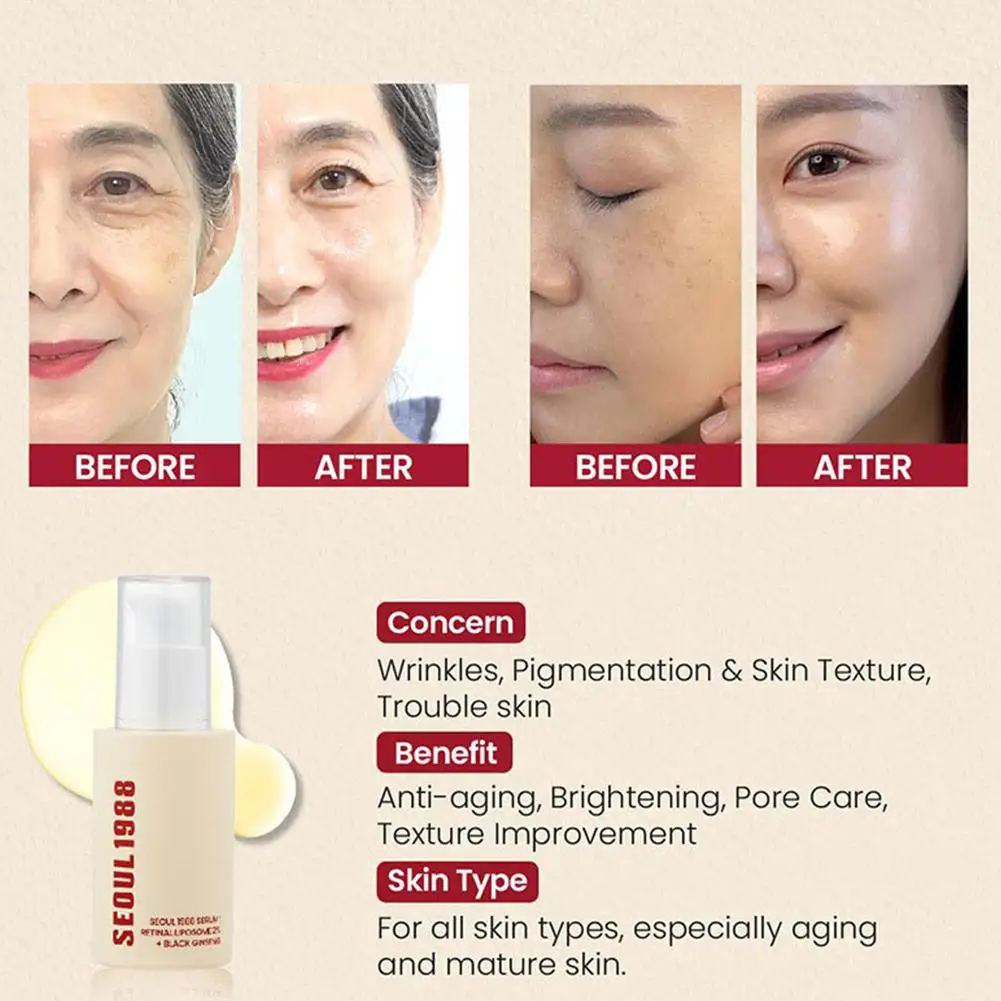 Seoul 1988 30ml Retinal Serum Brand Ginseng Facial Essence Closed Comedones Brightening Facial Moisturizing Korean Care Essence