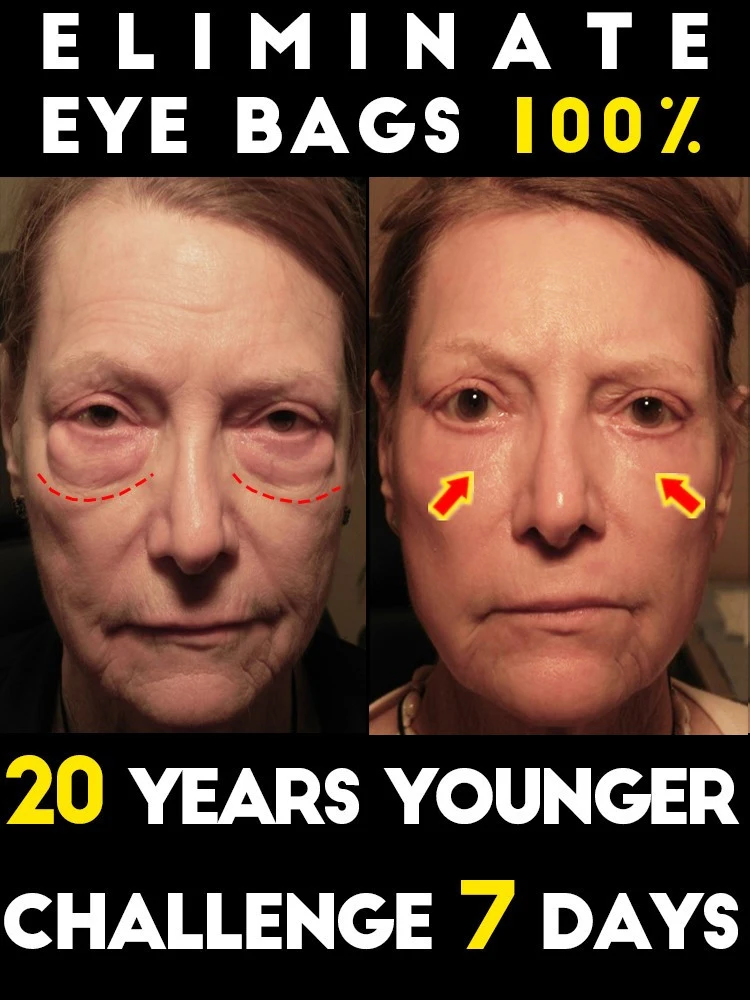 Improving eye problems