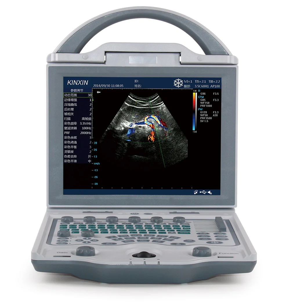 Ultrasound Scanner Portable Ultrasound Veterinary Machinery Professional 3D Real Time Echo Canine Ultrasound Scanner