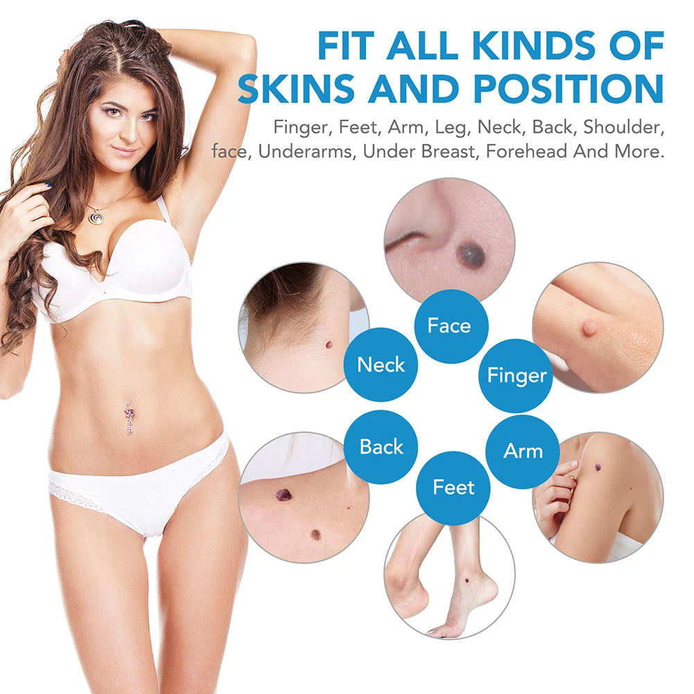 2-IN-1 Auto Skin Tag Removal T - Luxury Skincare Acne review and price