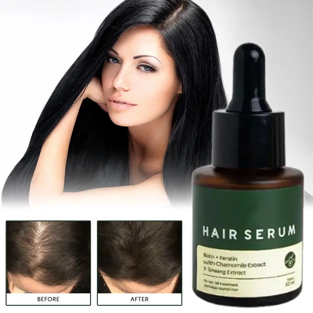 مغذي للعناية بالشعر، ظروف الزيوت العطرية، شعر فروة الرأس يقلل من التجعد، 20 مل، جذور الشعر W8G4 #5