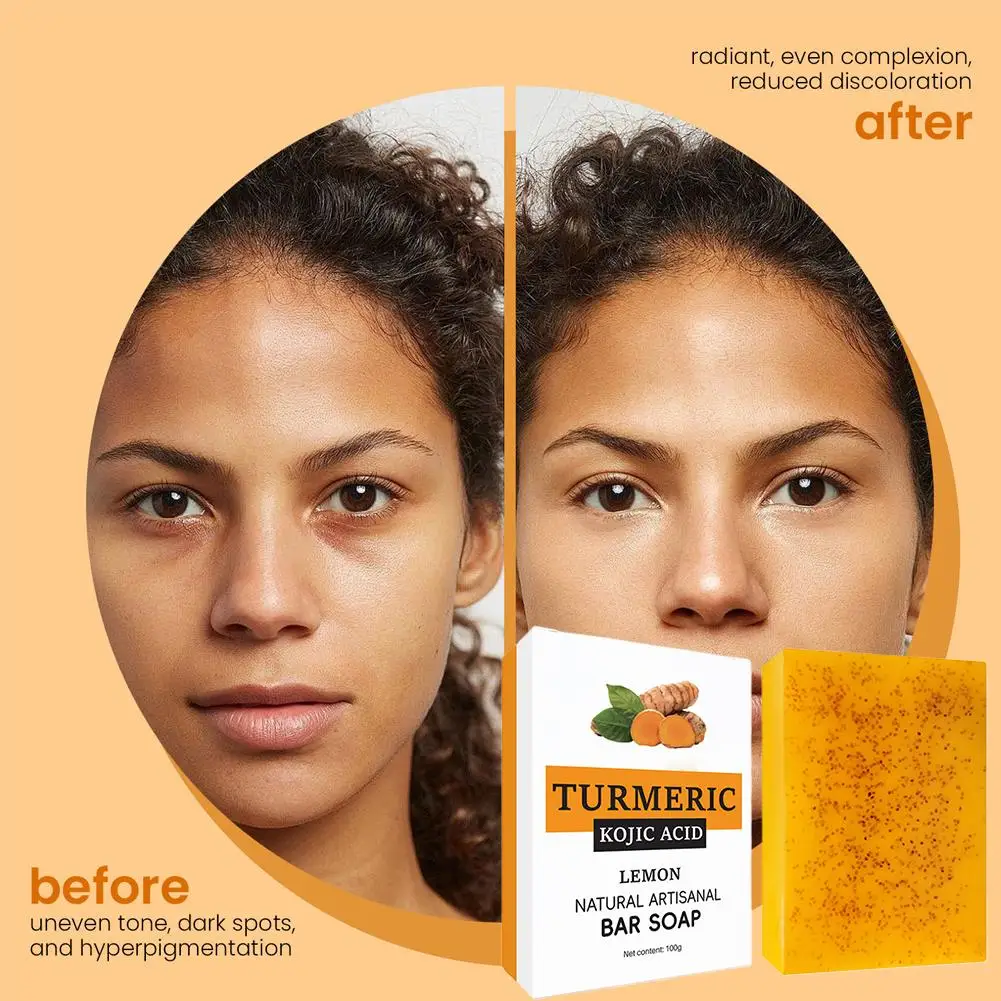 صابون الكركم لتنظيف الوجه ومضاد لحب الشباب وتبييض البشرة وتفتيح الوجه وإزالة البثور وتفتيح الزنجبيل صابون يدوي الصنع