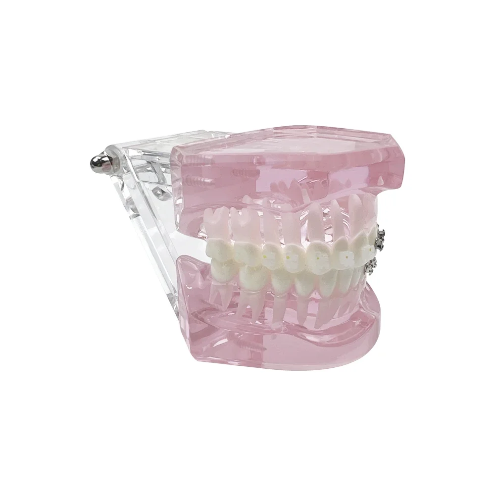 Dental Model Teeth Teaching Model With Self Ligating/ Metal/ Lingual/ Ceramic Orthodontic Brackets Teeth Model For Studying Demo