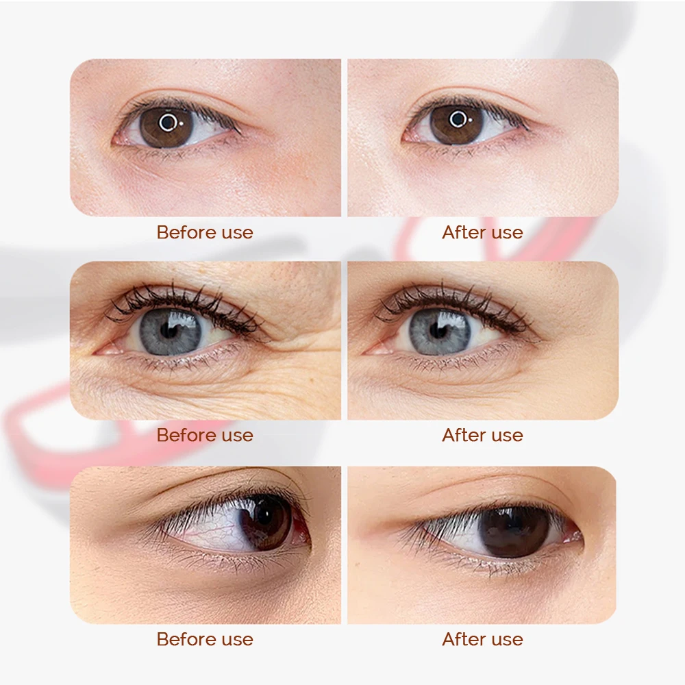 Thumbnail 3 - #26 Cheap Eye Massagers Worth Buying