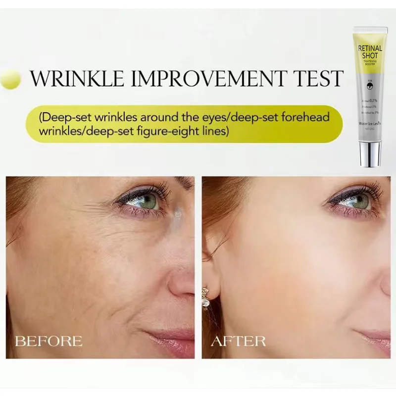 مصل عين معزز لشد الشبكية مع 0.1% شبكية و3% HA لشد البشرة وترطيبها وتنعيم البشرة.