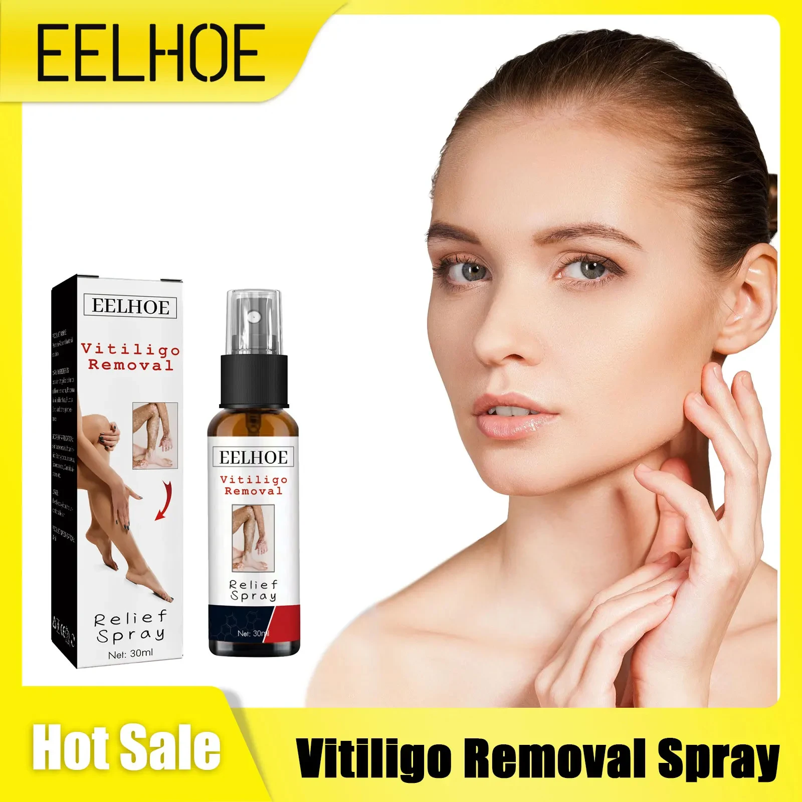 

Vitiligo Removal Spray Moisturize Improve Pigmentation Leukoplakia Anti Melanin Remove Ringworm Lamp White Spots Treatment Spray