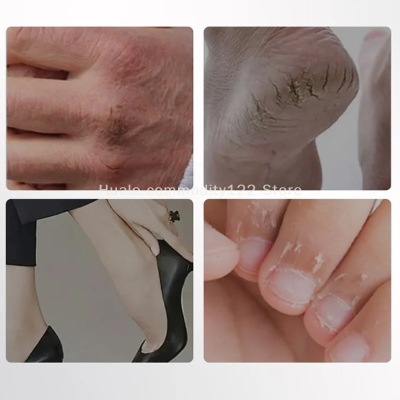 50/100 szt. Plastry na popękane dłonie i stopy, regulowane, samoprzylepne, ochronne na suche, popękane stopy, taśma ochronna na kołnierze stóp, przeciwbolesne wkładki do butów.