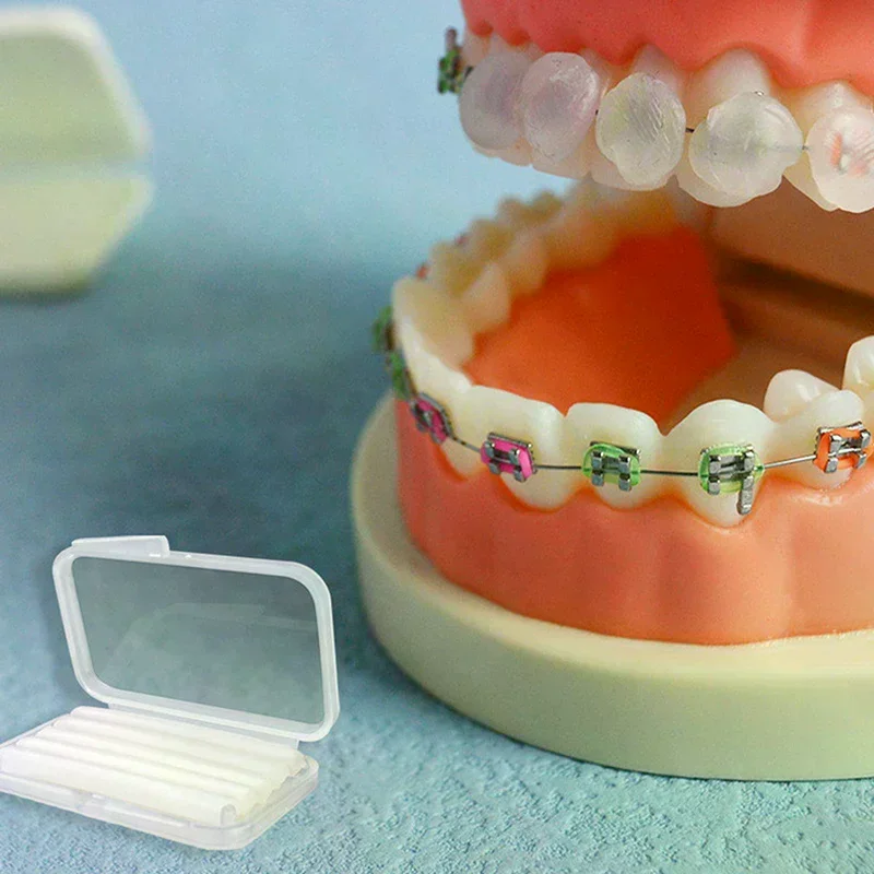 /ACR/Pcs/Box Dental  Ortho Wax Mint Mix Scent For Braces Bracket Gum Irritation Teeth Whitening Oral Hygiene Tools 5