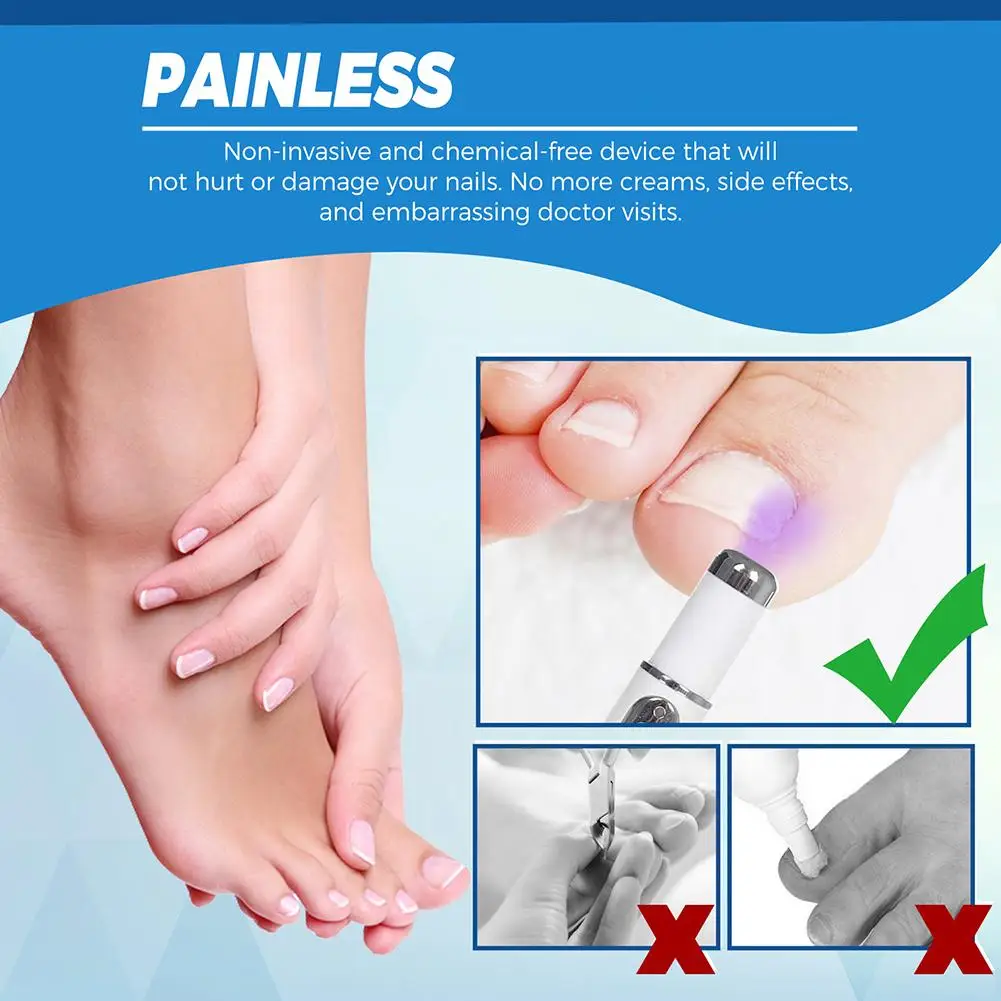 Nail Fungus Laser Cure Machine Nail Treatments Device Infection Onychomycosis Foot Anti Paronychia Care Removal Care Nail E1D7