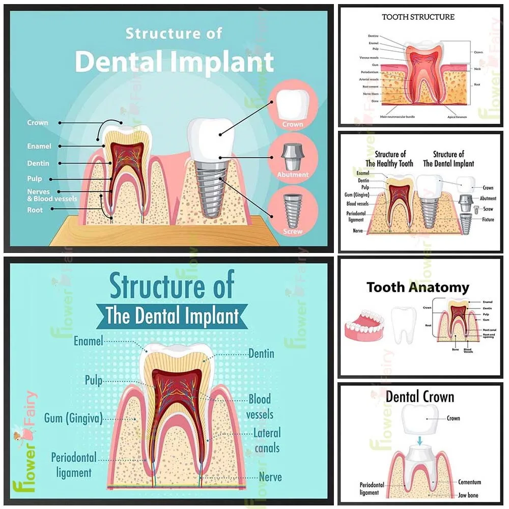 Cartoon Teeth Tooth Dentistry Clinic Dental Implant Poster Wall Art Canvas Painting Decor Wall Pictures For Living Room Unframed