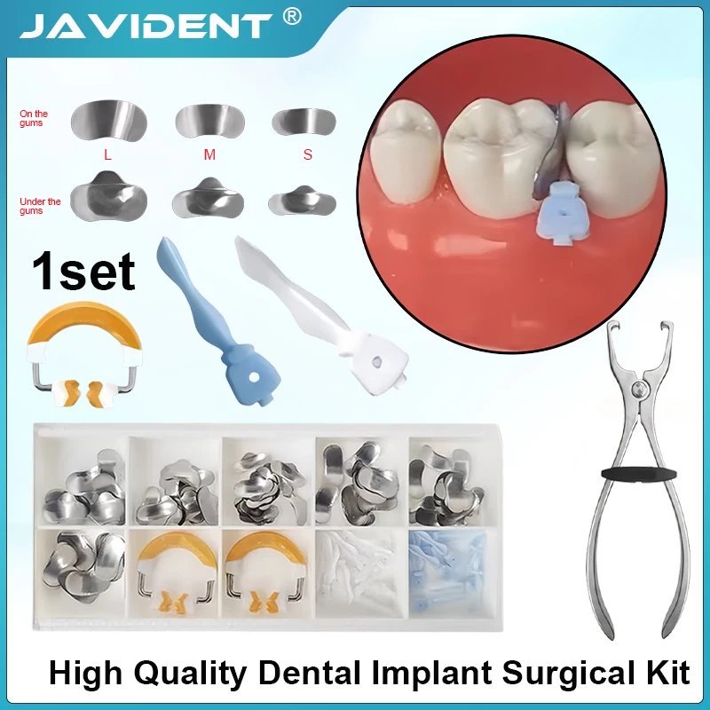 Douban Forming System Kit Segmented Matrix System Kit High-Quality Accessories Dentistrys  Materials