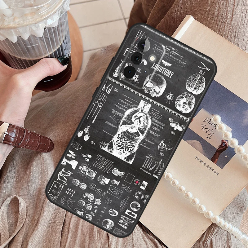 Radiological Human Organs Skeleton Funda Phone Case For Samsung Galaxy A14 A13 A12 A54 A53 A52 A34 A33 A32 A24 A23 A22 A51 A71